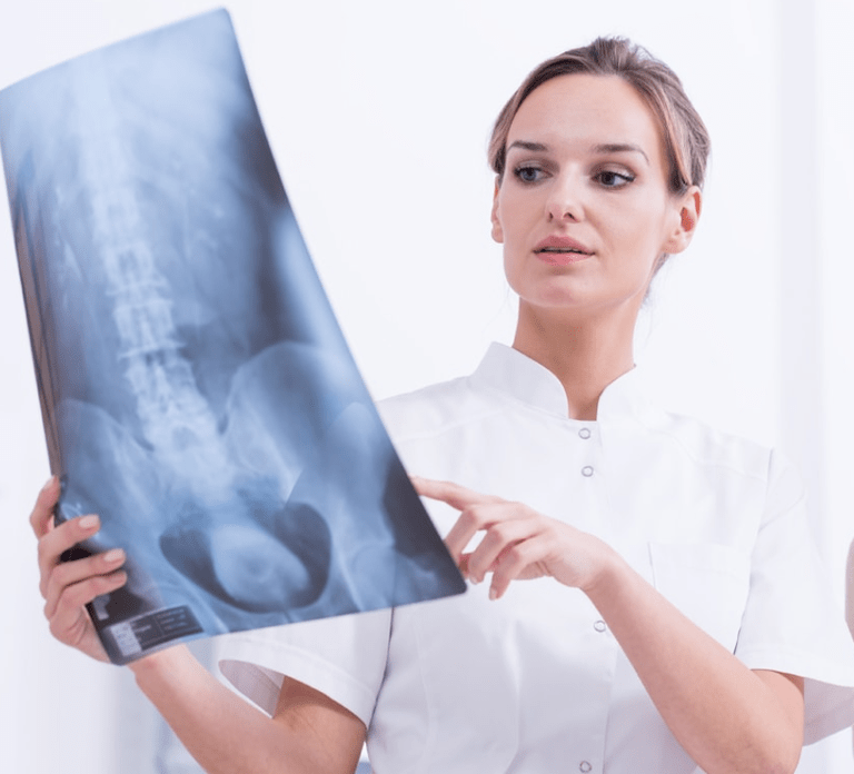 Ko'krak osteokondrozining rentgen tekshiruvi yordamida tashxisi